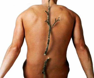 Zbog čega se javlja osteoporoza?