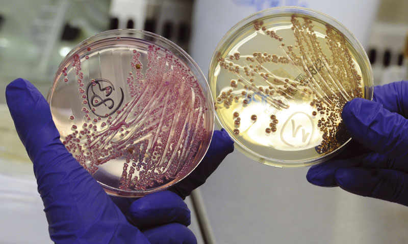 Najjači lek za lečenje Escherichie Coli
