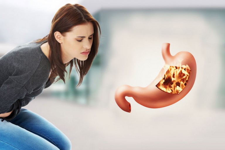 Prirodna rešenja protiv želudačni tegoba