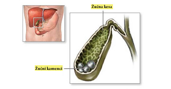 kamm