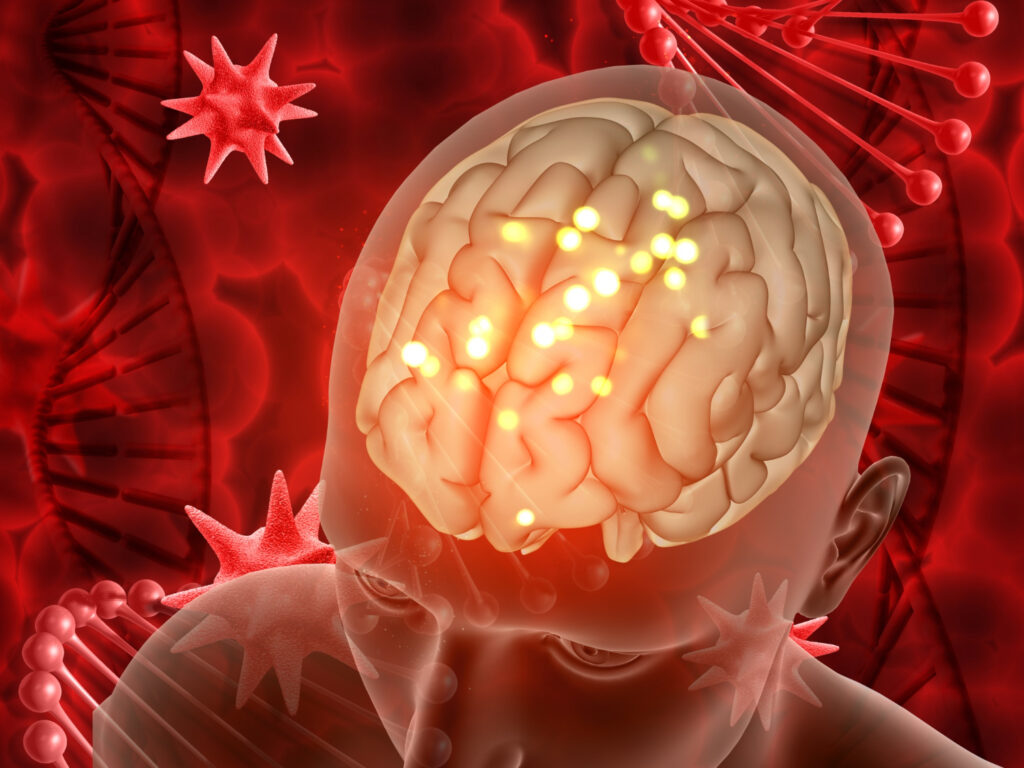 tumor na mozgu